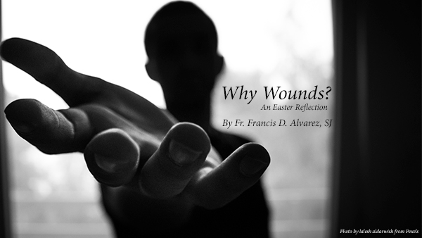 Why Wounds? (An Easter Reflection)